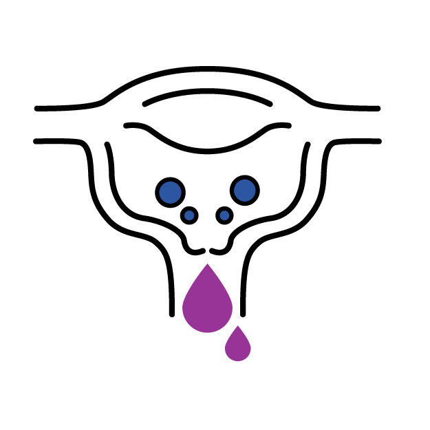 Graphic icon of a uterus with discharge